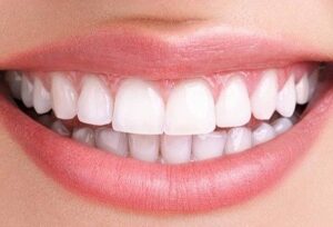 Invisalign perfect teeth